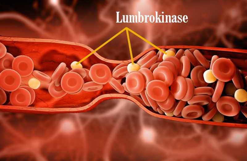 lumbrokinase enzymes