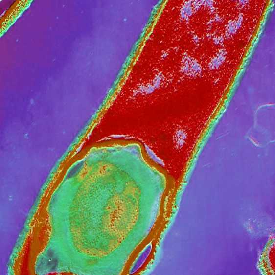 Clostridium Perfringens là gì