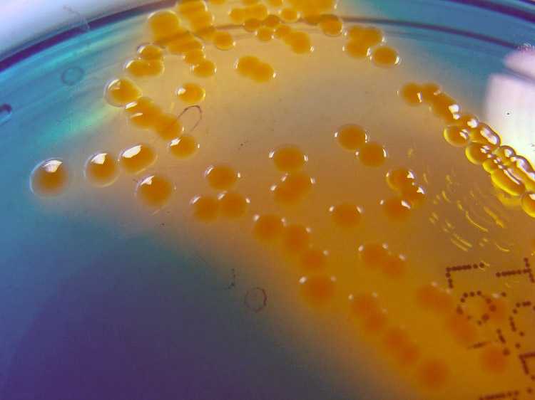 Vibrio Cholerae là gì